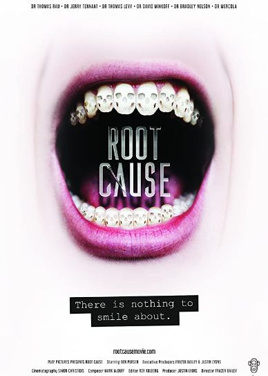 Root Cause Cover
